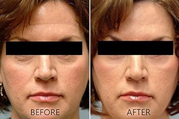 Vitamin C Serum 20% Pure L-Ascorbic Acid, Ferulic Acid, Vitamin E And Ha And Hyaluronic Acid Serum With Vitamin B5 For Face And Eyes Natural Anti Aging Anti Wrinkle Set Of 2 By Dr. Brenner : Beauty & Personal Care