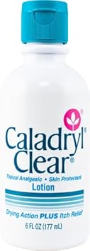Lotion For Dry Skin By Caladryl, Topical Analgesic For Itch Relief, 6 Fl Oz