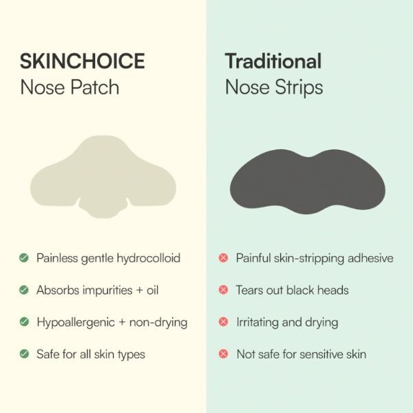 Skinchoice Breakout Nose Pore Strips, 10 Nose Pore Patches