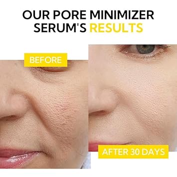 Lanbena Pore Minimizer Serum, Pore Minimizer & Reducer For Face, Minimizing, Shrinking, Oil Control Firming, Tightening Pores, 100% Vegan Pore Moisture After Blackhead Remover, 0.5 Fl.Oz : Beauty & Personal Care