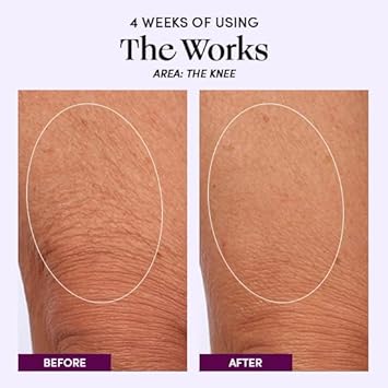 Womaness The Works All-Over Toning Body Cream – Hydrating & Smoothing Firming Body Lotion – Anti Aging Skin Tightening Cream For Body With Niacinamide & Hyaluronic Acid – Menopause Body Care – 200Ml : Beauty & Personal Care