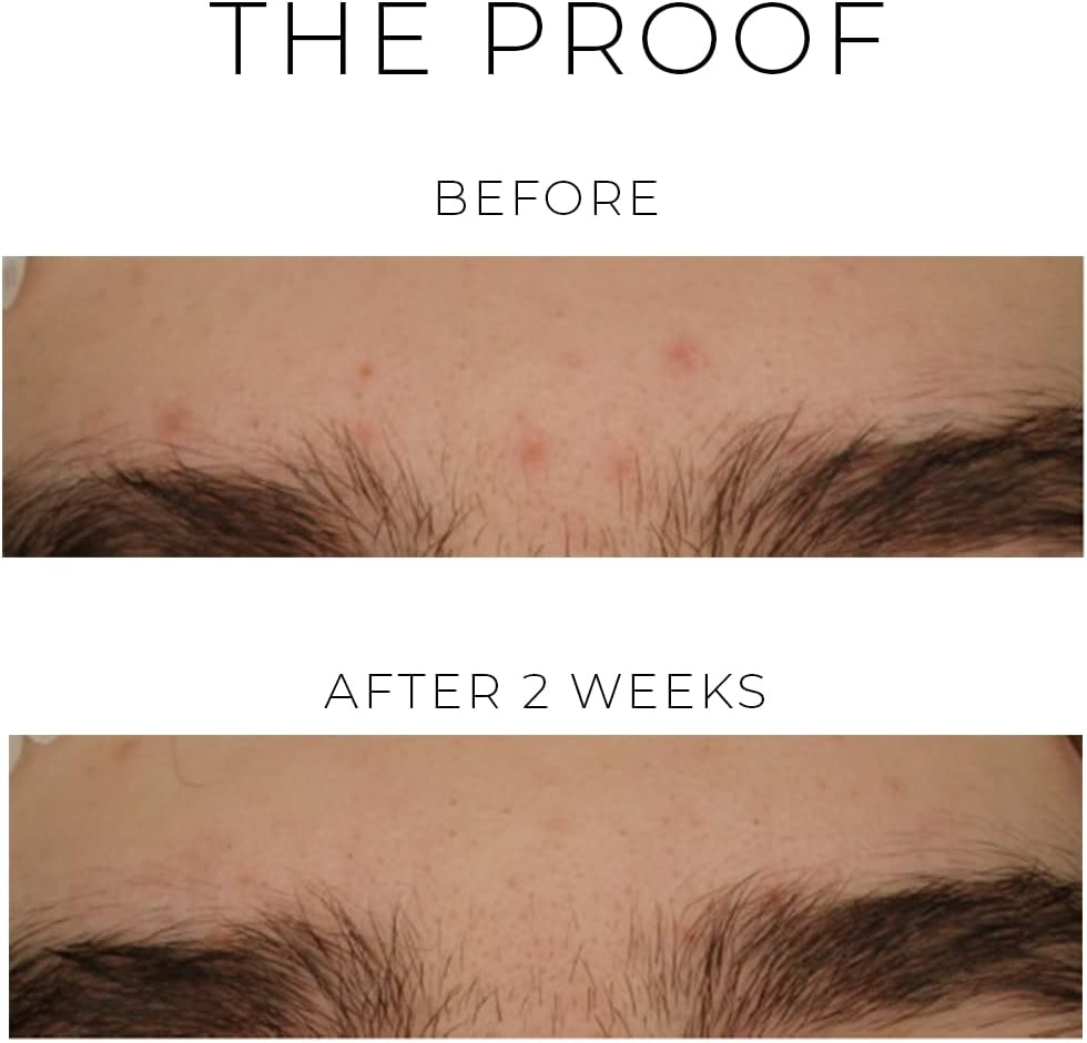 OSKIA Violet Water Hydra Gel β Lightweight Gel Moisturiser with Colloidal Silver & Niacinamide for Blemish Prone Skin : Amazon.co.uk: Beauty