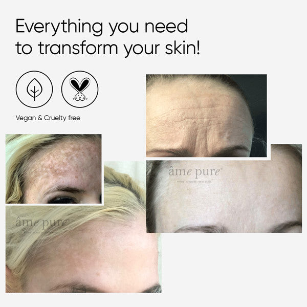 Âme Pure Wrinkleraser™ Basic 0.5Mm