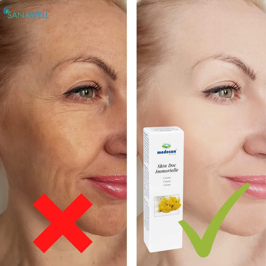 Medosan Skin Doc Immortelle 100Ml