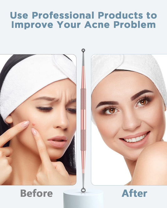 Bestope Blackhead Remover Blackhead Removal Pimple Comedone Extractor Tool - Treatment For Blemish Whitehead Popping Zit Removing With Metal Case (Silver)