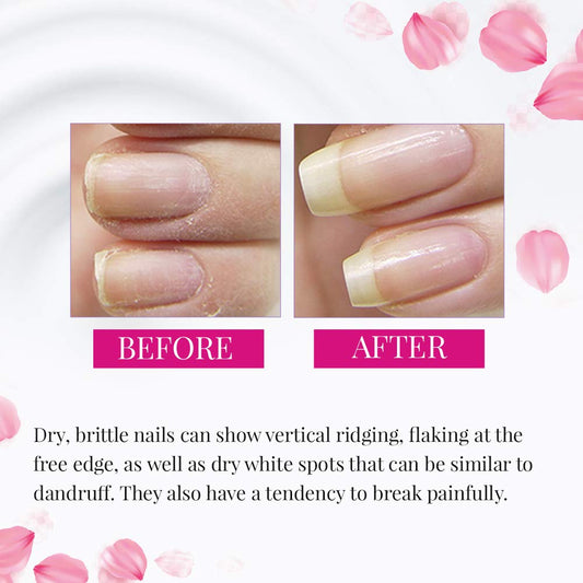 Nail Tek Foundation 3, Ridge Filling Strengthening Base Coat For Hard And Brittle Nails, 0.5 Oz, 2-Pack