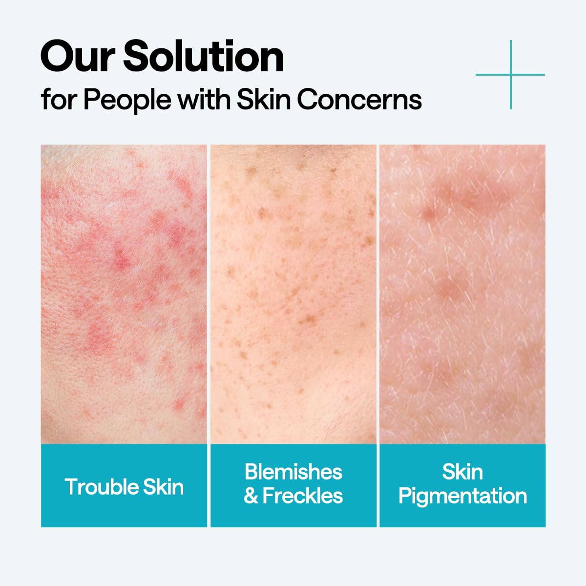 Mediheal Madecassoside Repair Serum 1.35 Fl.Oz - Blemish Care, Fades Pigmentation And Freckles & Skin Soothing & Hydration - With Centella Asiatica, Niacinamide : Beauty & Personal Care