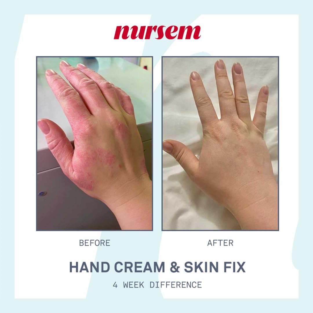 Nursem Caring Hand Cream β 300ml | Fast-Absorbing Natural Hand Cream for Very Dry Skin | Fragranced Moisturizer for Deep Hydration, Skin Repair & Protection for Dry, Cracked Hands : Amazon.co.uk: Beauty