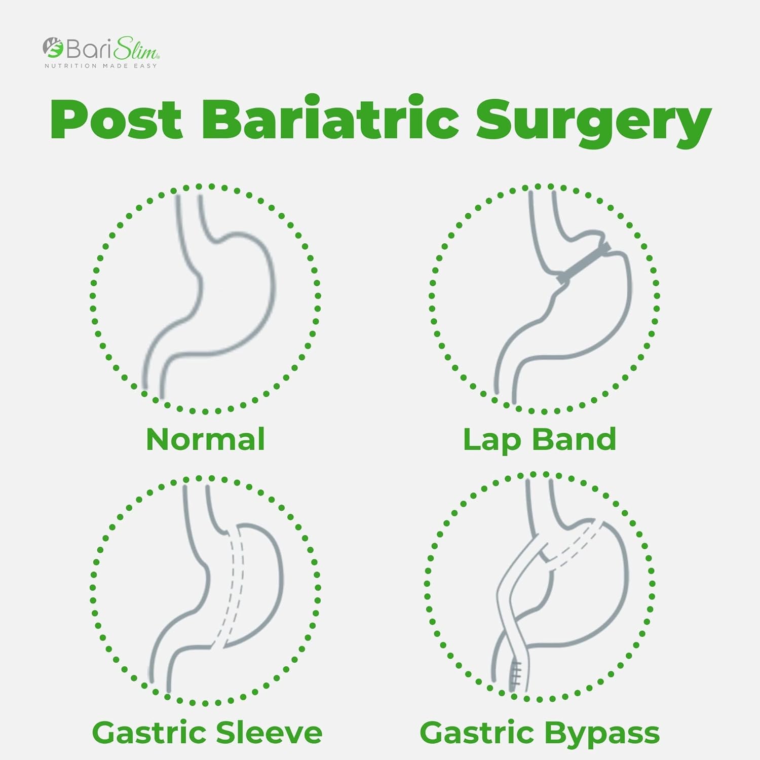 BariSlim Bariatric Calcium Citrate with Magnesium & Vitamin D Tabs - 500mg Calcium Citrate - Formulated for Post Weight Loss Surgery - Supports Bone Health | Raspberry Flavor : Health & Household