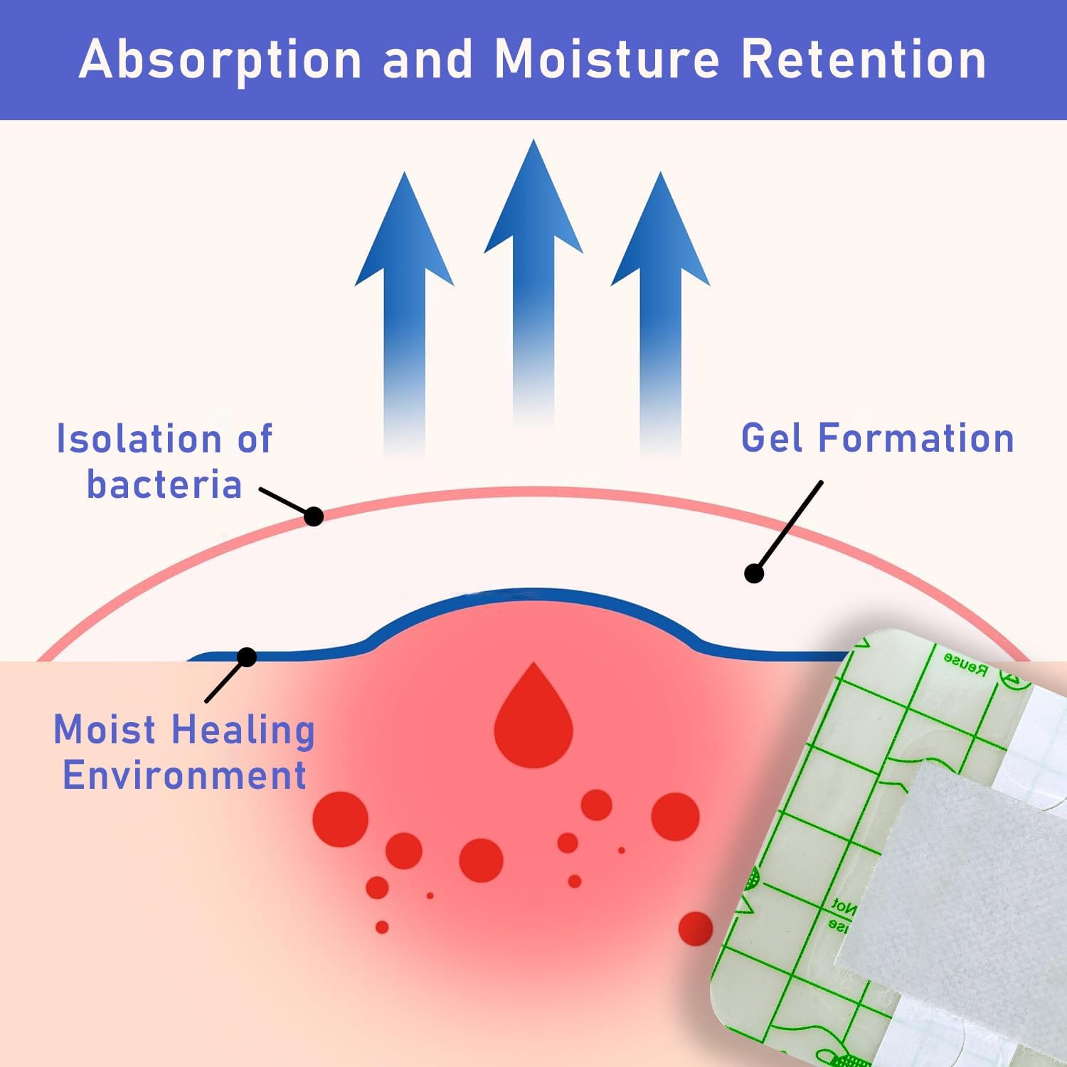 VED Dermapore Waterproof Adhesive Wound Dressing- Suitable for cuts and grazes, Diabetic Leg ulcers, venous Leg ulcers, Small Pressure sores- Medium,9 x 15cm (Pack of 5). : Amazon.co.uk: Health & Personal Care
