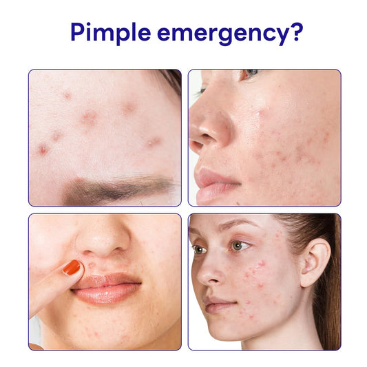 Mediheal Derma Clear Madecassoside Blemish Patch (44 Counts) - Acne Spot Protection, Fast Healing With Madecassoside & Niacinamide