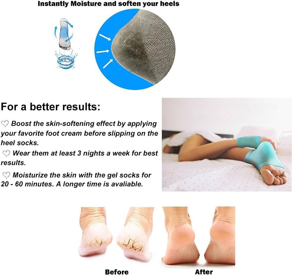 3 Pairs Moisturizing Vented Socks, Relieve Heel Pain - Comfortable Soft Gel Socks For Men & Women, Day & Night Care, Dry Cracked Skin, High Heel, (Grey, Pink, Green)