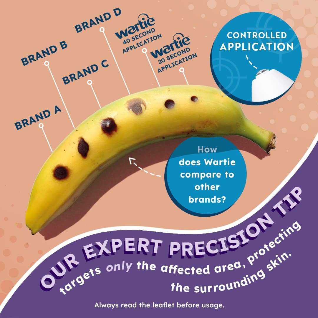 Wartie Freeze Wart and Verruca Remover, Safe For Adults and Children Aged 4+, Fast Acting Wart and Verruca Treatment For Hands and Feet, Contains 15 Applications, White, 50 ml (Pack of 1) : Amazon.co.uk: Health & Personal Care