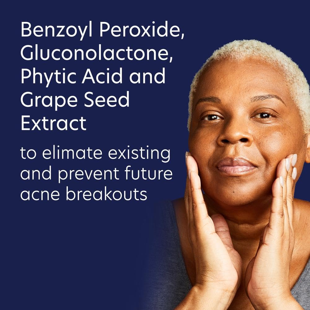 PCA SKIN 5% Benzoyl Peroxide Face Wash, Foaming Acne Facial Cleanser for Oily and Acne Prone Skin, Eliminates Existing Acne and Helps Prevent Future Breakouts, Cleanses and Calms, 7.0 oz Bottle : Beauty & Personal Care