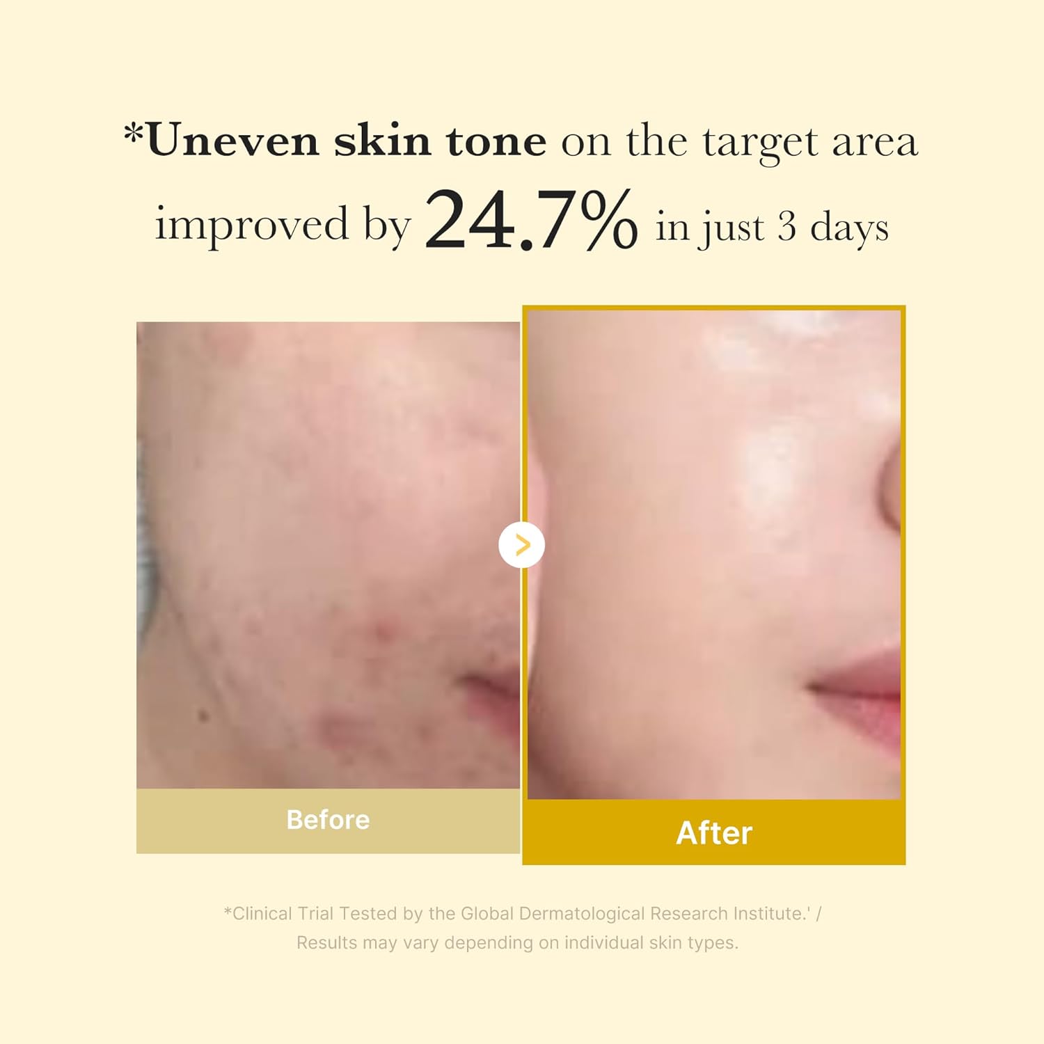 Medicube Pdrn Caffeine Overnight Wrapping Peel Off Facial Mask | Firming, Depuffing & Hydration | Salmon Dna + Caffeine + Collagen For Refined, Glass Skin & Face Contour Support | Korean Skin Care : Beauty & Personal Care