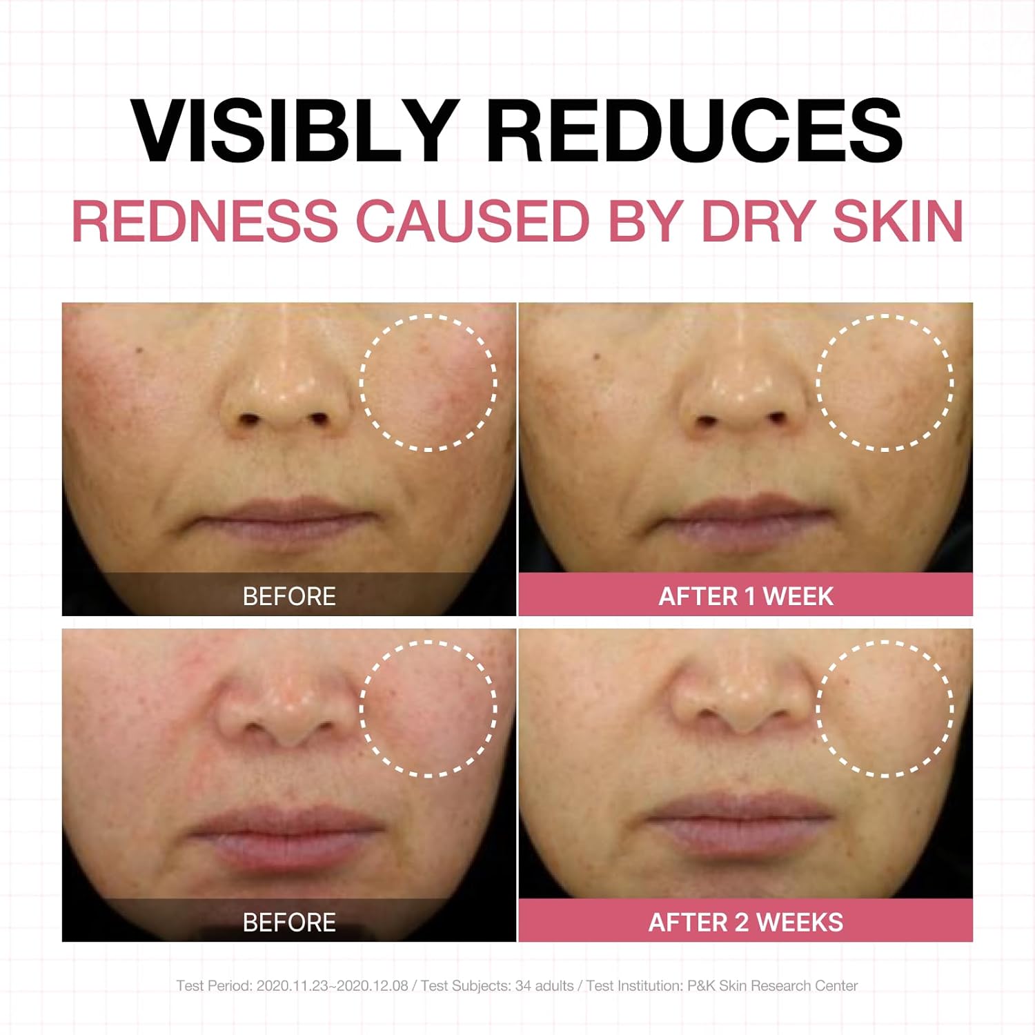 Physiogel Calming Relief Face And Body Lotion, Reduces Redness In Just 3 Days, Moisturizer For Dry, Red, Itchy, Sensitive Skin, Korean Skin Care, Fragrance-Free, Non-Comedogenic, Dermatologist-Tested : Beauty & Personal Care