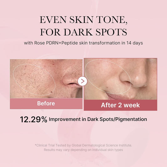Medicube Pink Glow Home Care Duo: Pdrn Pink Peptide Toner And Collagen Jelly Cream (110Ml)