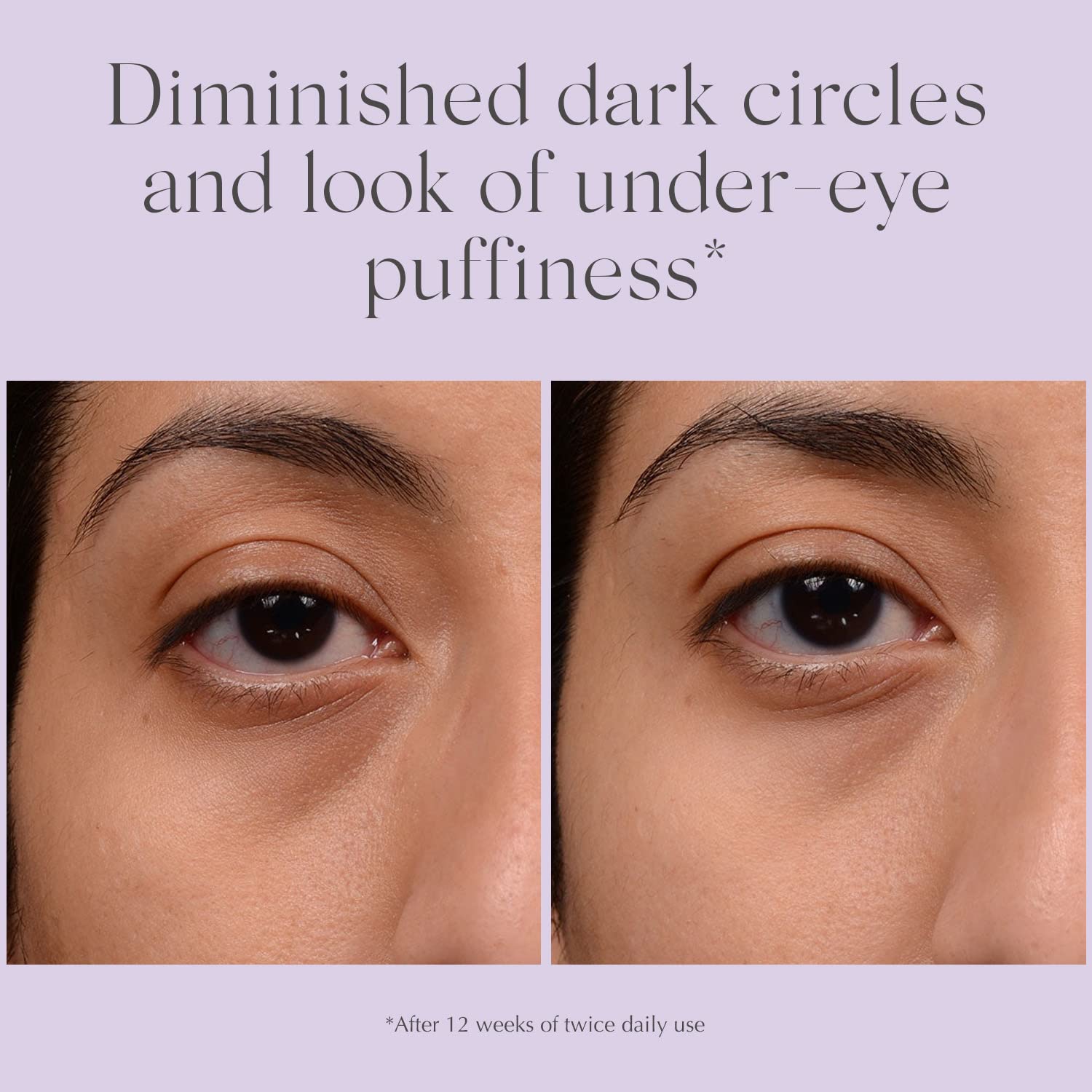 Exuviance Bright Eyes Dark Circle Corrector Hydrating Eye Cream With Algae Extracts, Peptides, Polyhydroxy + Bionic Acids, Fragrance-Free, 15 G. : Beauty & Personal Care