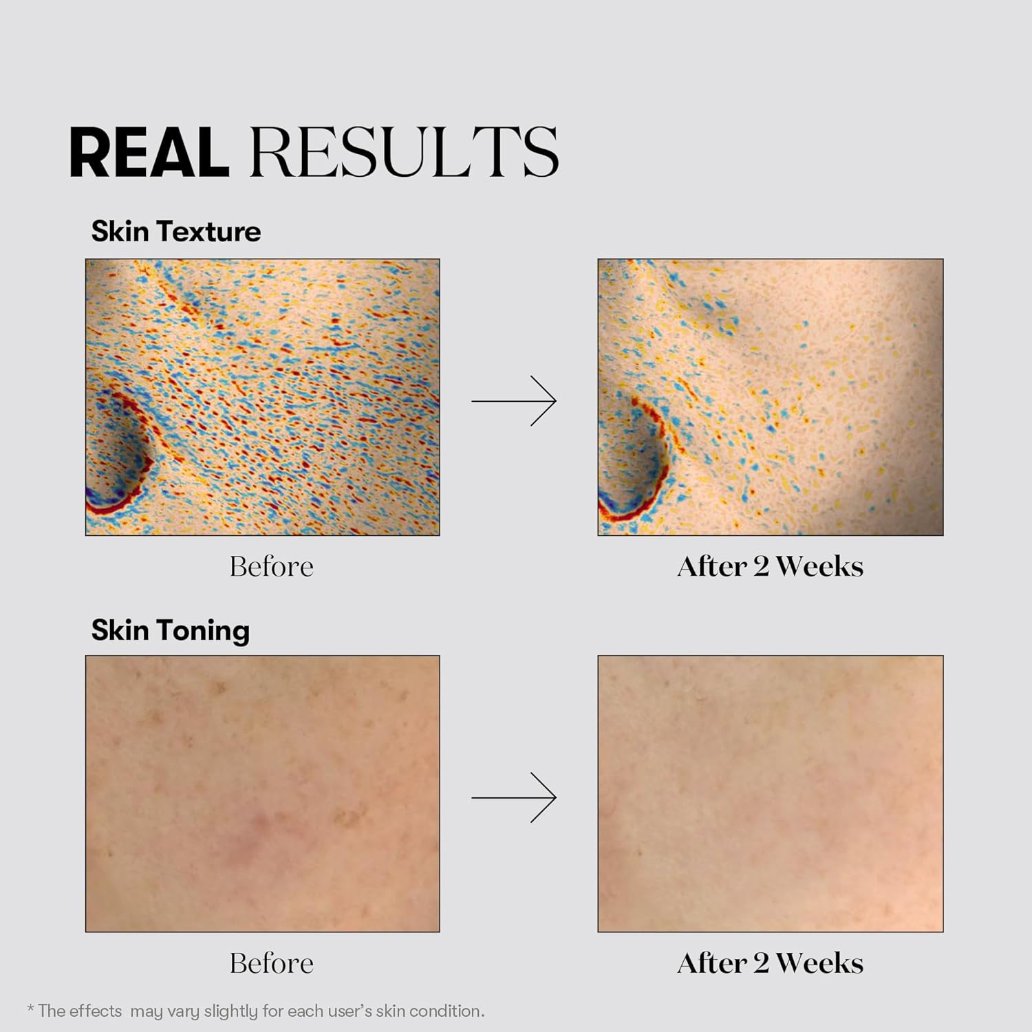 Vt Cosmetics Tx Toning Facial Toner With Tranexamic Acid, Niacinamide, Glutathione, Hydrating, Refreshing Toner For Dark Spots, Acne Scar, Sun Spots, Age Spots, Korean Skin Care (6.76 Fl. Oz.) : Beauty & Personal Care