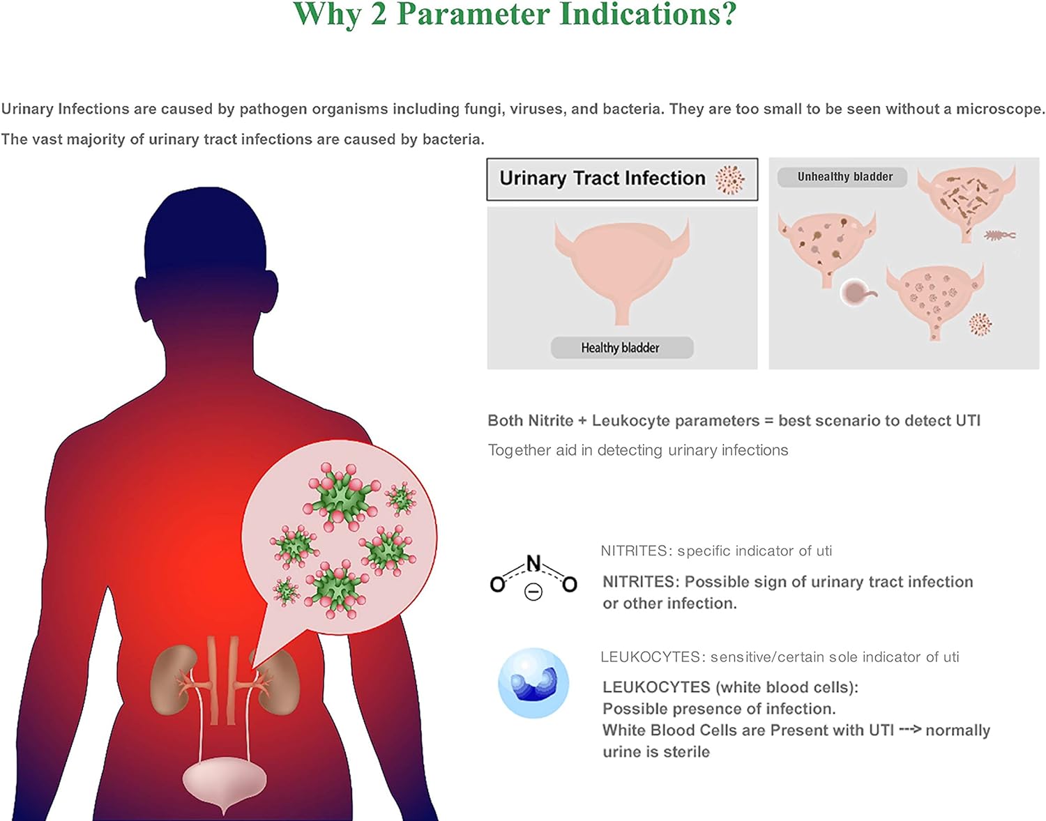 Easy@Home 20 Individual Pouches Urinary Tract Infection FSA Eligible Test Strips (UTI Test Strips) Monitor Bladder or Urinary Tract Issues by Testing Urine, 20 Tests/Box-FDA Cleared (UTI-20P) : Health & Household