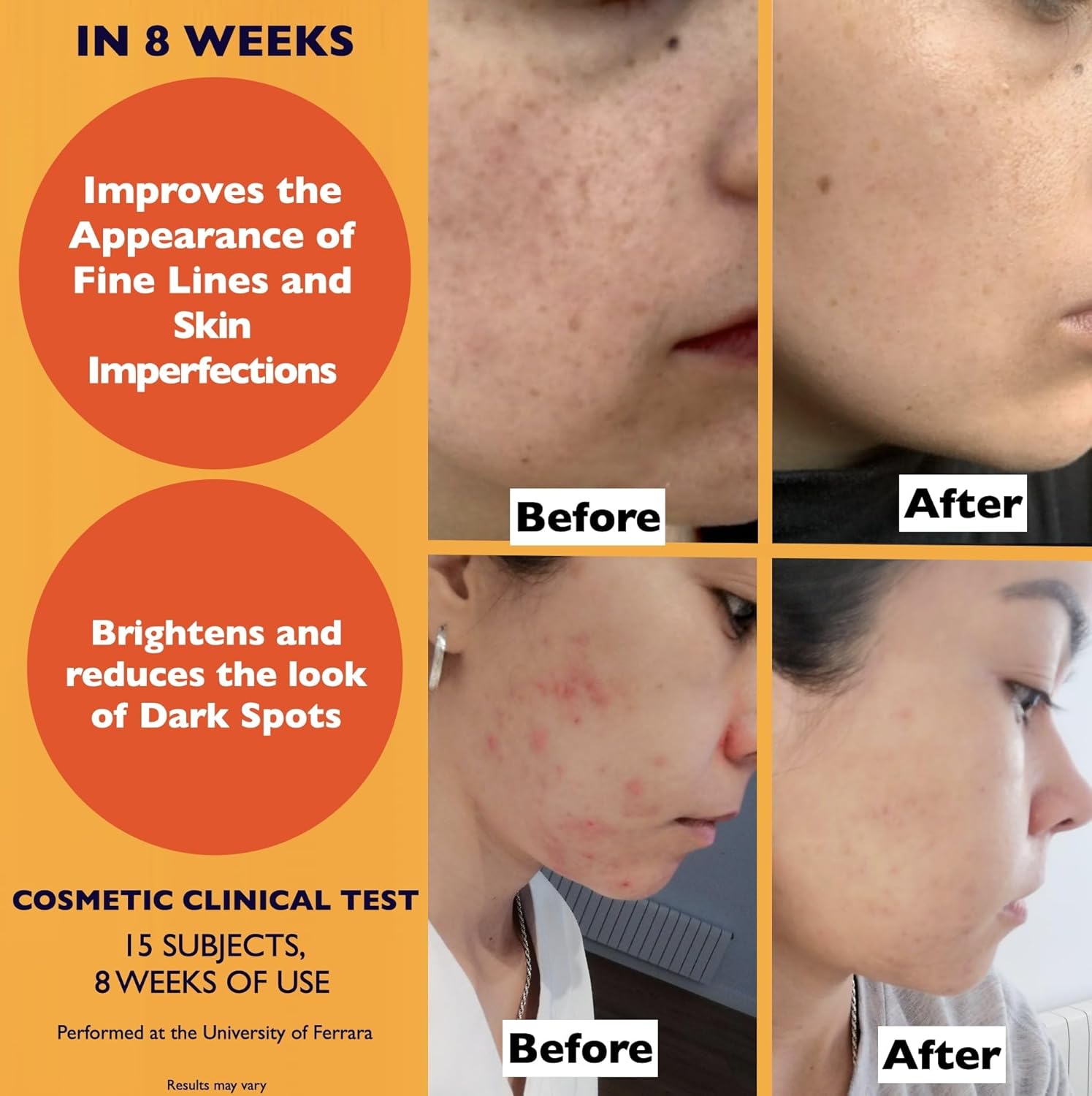 Big 2.11oz. Organic Vitamin C Serum for Face. Anti-Dark Spots, Wrinkles Skin Repair Serum with Hyaluronic Acid, Vitamin C & Niacinamide. All-in-One Brightening, Anti Aging Facial & Eye Area Skincare : Amazon.co.uk: Beauty