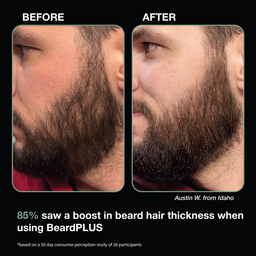 Zeus Beardplus Shampoo For Men, Enhanced Beard Growth & Hair Care Treatment With Biotin & Caffeine To Boost Thickness, Strength, Hydration, And Skin Comfort (Made In Usa) 6 Oz. : Beauty & Personal Care