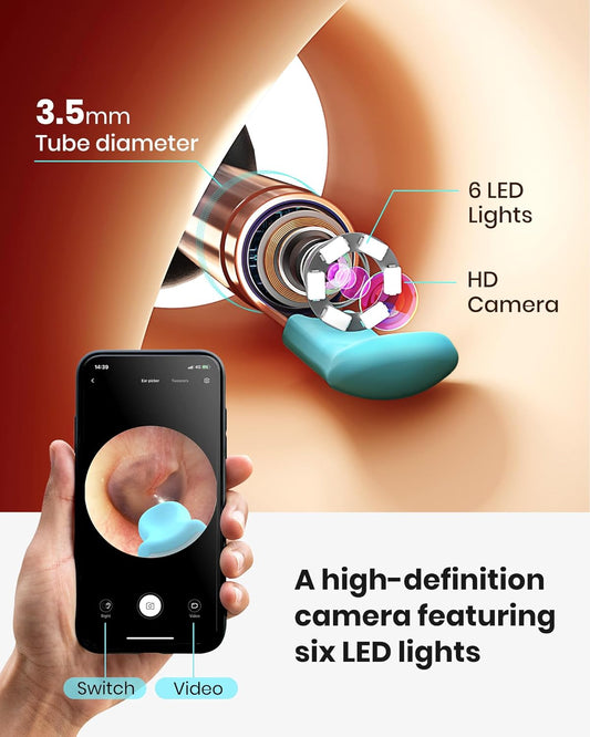 Bebird R1+ Ear Wax Removal Tool With Inspection Kit, Ear Cleaner With 300W Ear Camera, 1080P Ear Scope Otoscope, 7 Replacement Tips For Ear Pick, Safer Detachable Ear Scoop For Earwax Removal