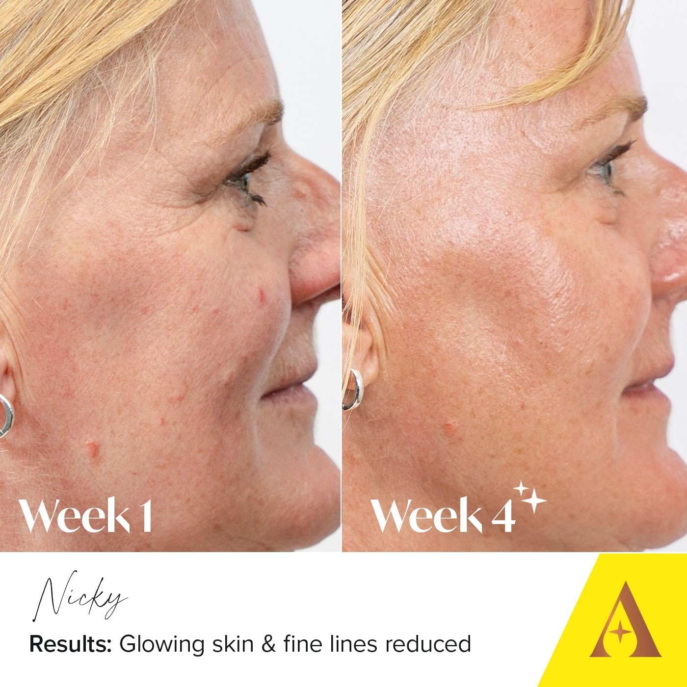 Absolute Collagen Deep Lift Night Cream 50ml - Nourishing & Hydrating - Repair & Restore Skin Barrier - Improves Skin Texture, Elasticity & Firmness - Reduce Appearance of Fine Lines - Anti-Ageing : Amazon.co.uk: Beauty