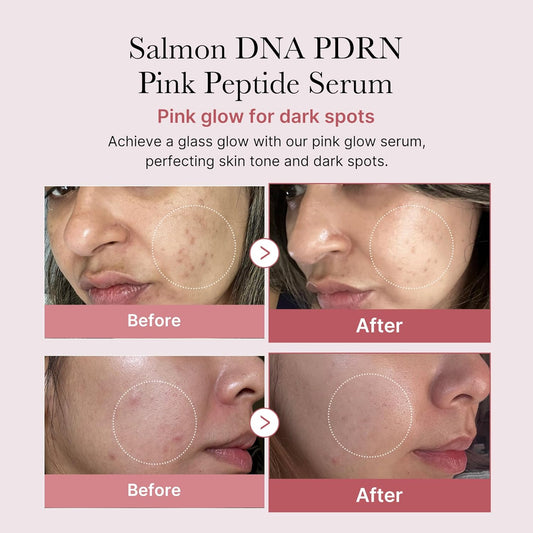Medicube Pdrn Pink Peptide Serum, Pink Glow Serum, Peptide, Niacinamide, Hydrating & Moisturizing & Firming, Uneven Skin Tone, Korean Skincare | 1.01 Fl.Oz. (1.01 Fl.Oz., Rose Pdrn (Vegan))