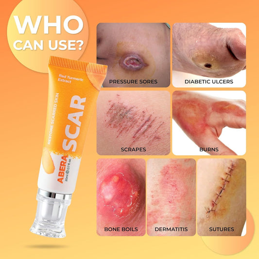 Abera Red Turmeric Scar Removal Cream (Premium Product) - Advanced Treatment For Face And Body With Natural Ingredients Scar Rapidly Removes Stretch Marks, Keloids, Burns, And More