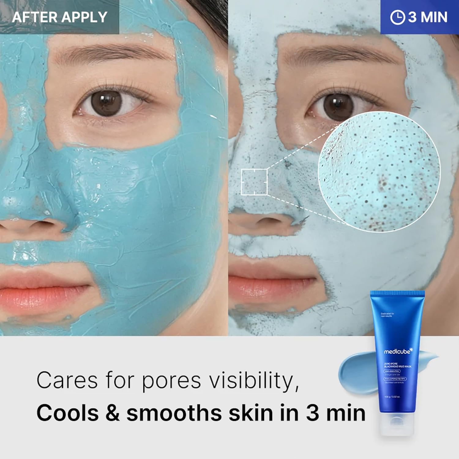 Medicube Zero Pore Blackhead Mud Mask With Jelly Brush : Beauty & Personal Care