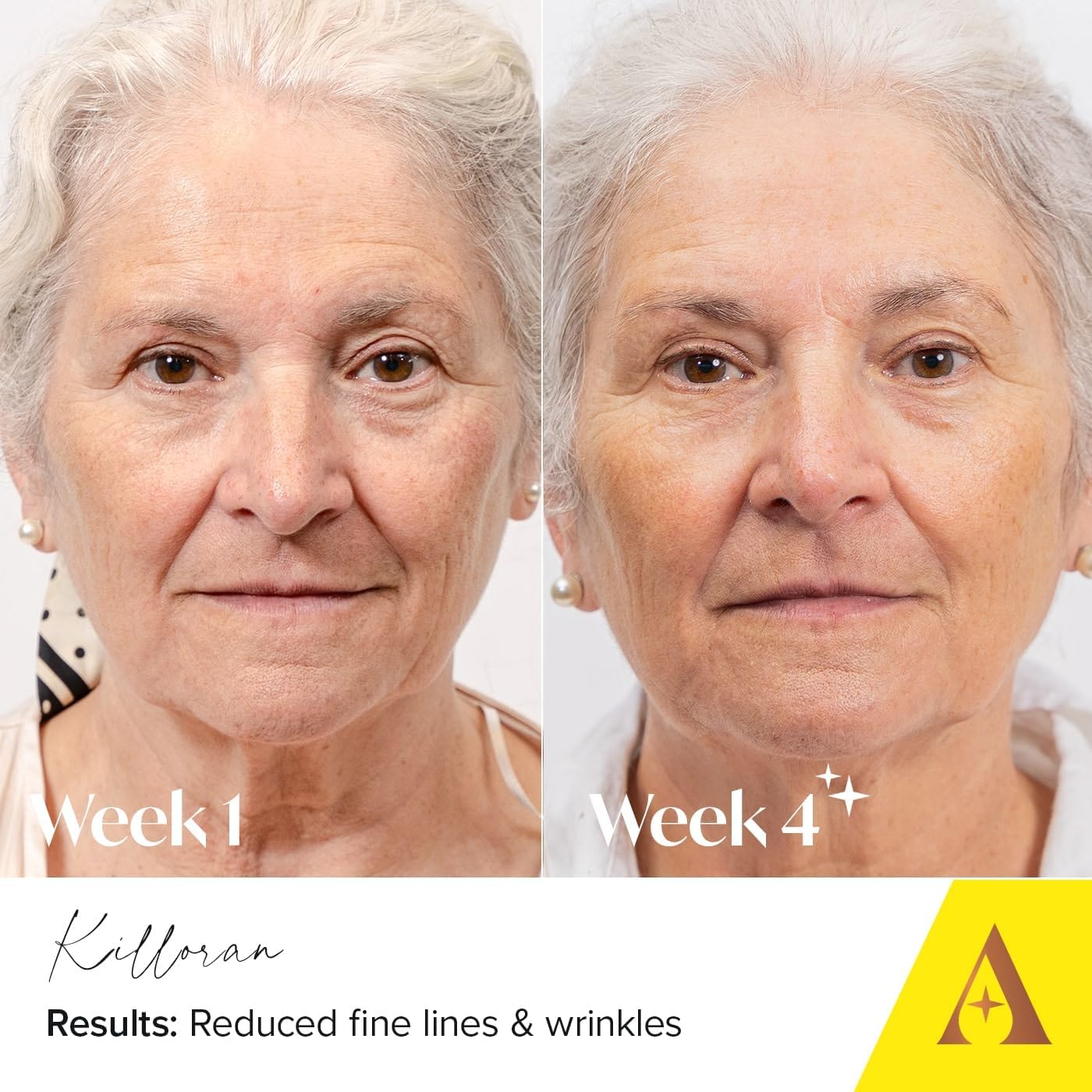 Absolute Collagen Deep Lift Day Cream SPF30 - Hydrating Face Moisturiser with UVA/UVB Protection - Collagen Boosting Formula Increases Skin Elasticity, Evens Skin Tone, Smooths & Firms - Anti-Ageing : Amazon.co.uk: Beauty