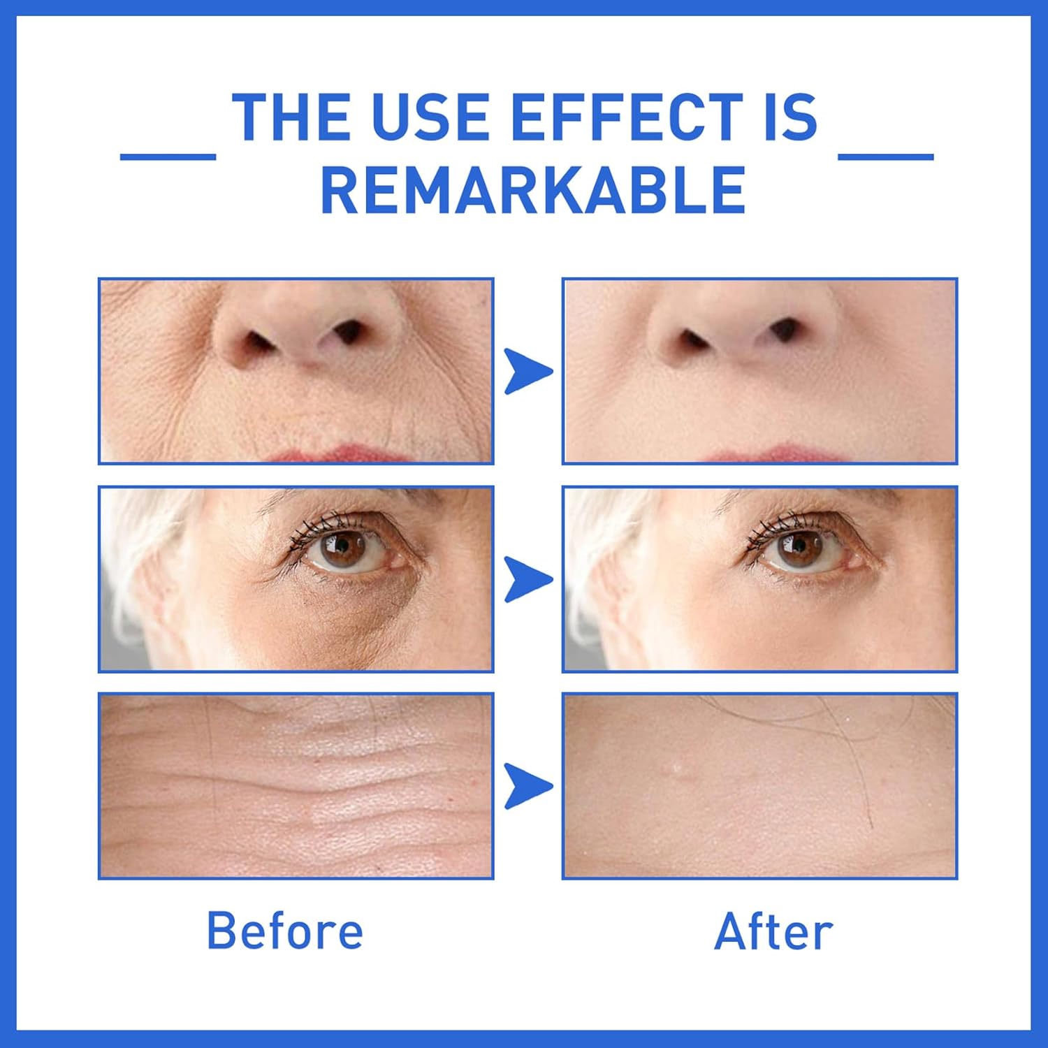 2Pcs Boto-X Stock SolutionBoto-X Face Serum UkCollagen Serum For Face Boto-X In A Bottle Boto-X Stock Anti Aging Serum For FaceReduce Wrinkles, Anti-Aging, Boost Skin Collagen(2Pcs)