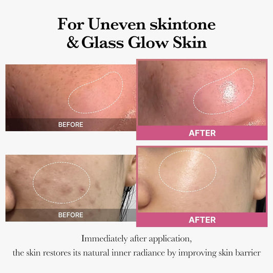 Medicube Pink Glass Glow Duo For Uneven Skin - Collagen Jelly Cream 50Ml - Niacinamide & Freeze-Dried Hydrolyzed Collagen + Salmon Dna Pdrn Pink Collagen Jelly Gel Mask (4Ea)