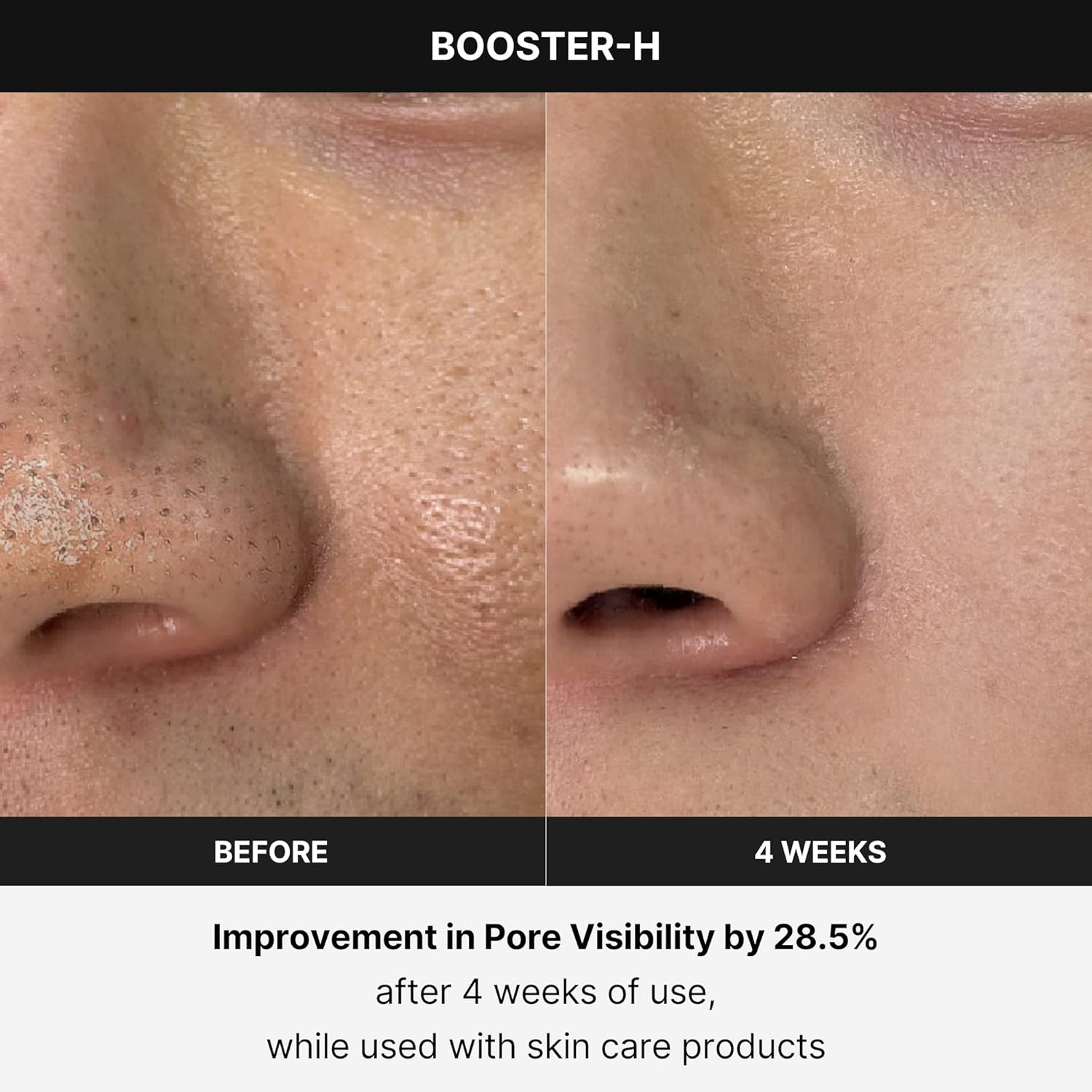 Medicube Booster H - Korean Skincare Tool - Facial Glow Booster For Maximizing And Boosting Skin Care Absorption - Needle Free : Beauty & Personal Care