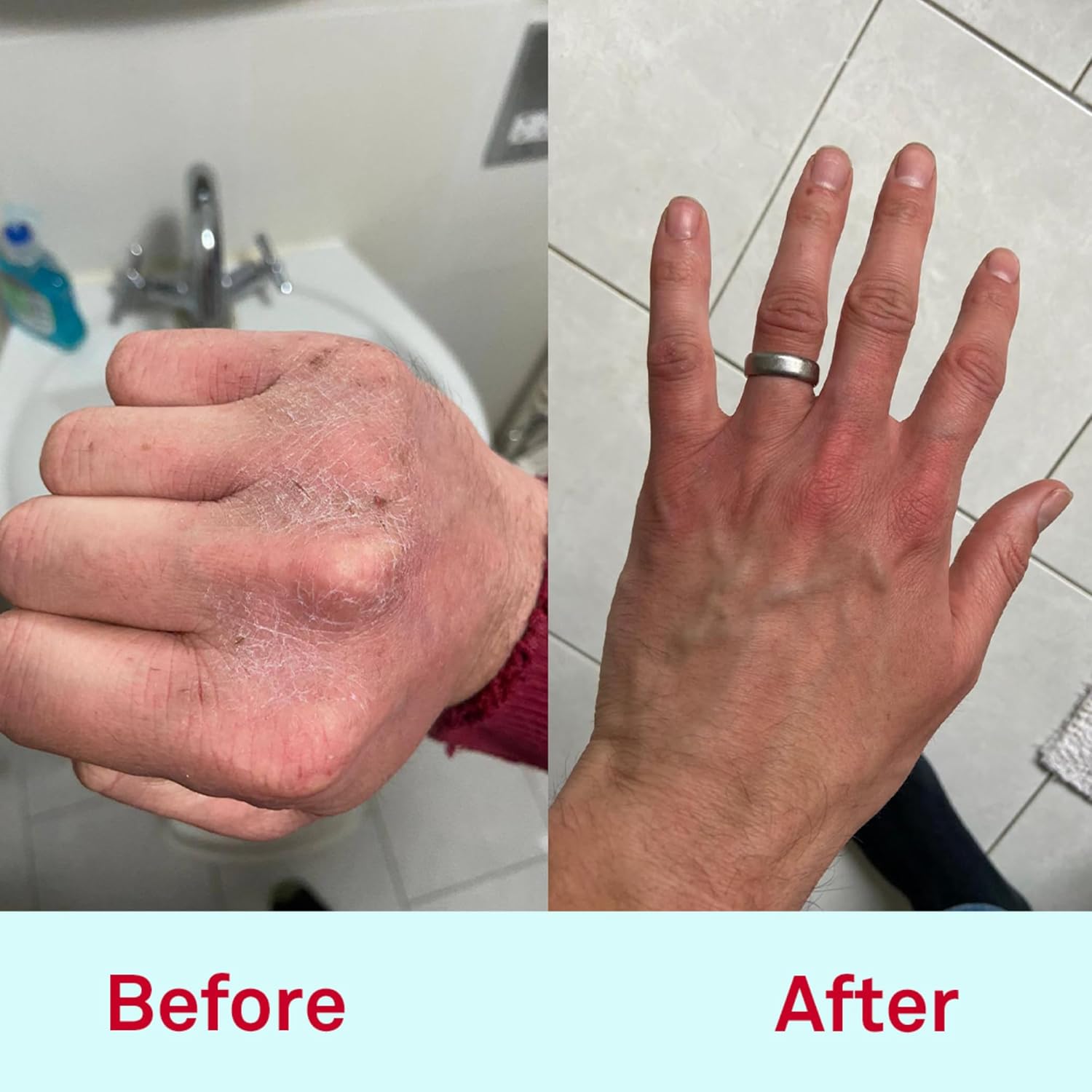 Nursem CARING HAND CREAM β 300ml | Fast absorbing and moisturising natural cream for hard working hands, repairing cream suitable for sensitive and dry skin (Unfragranced) : Amazon.co.uk: Beauty