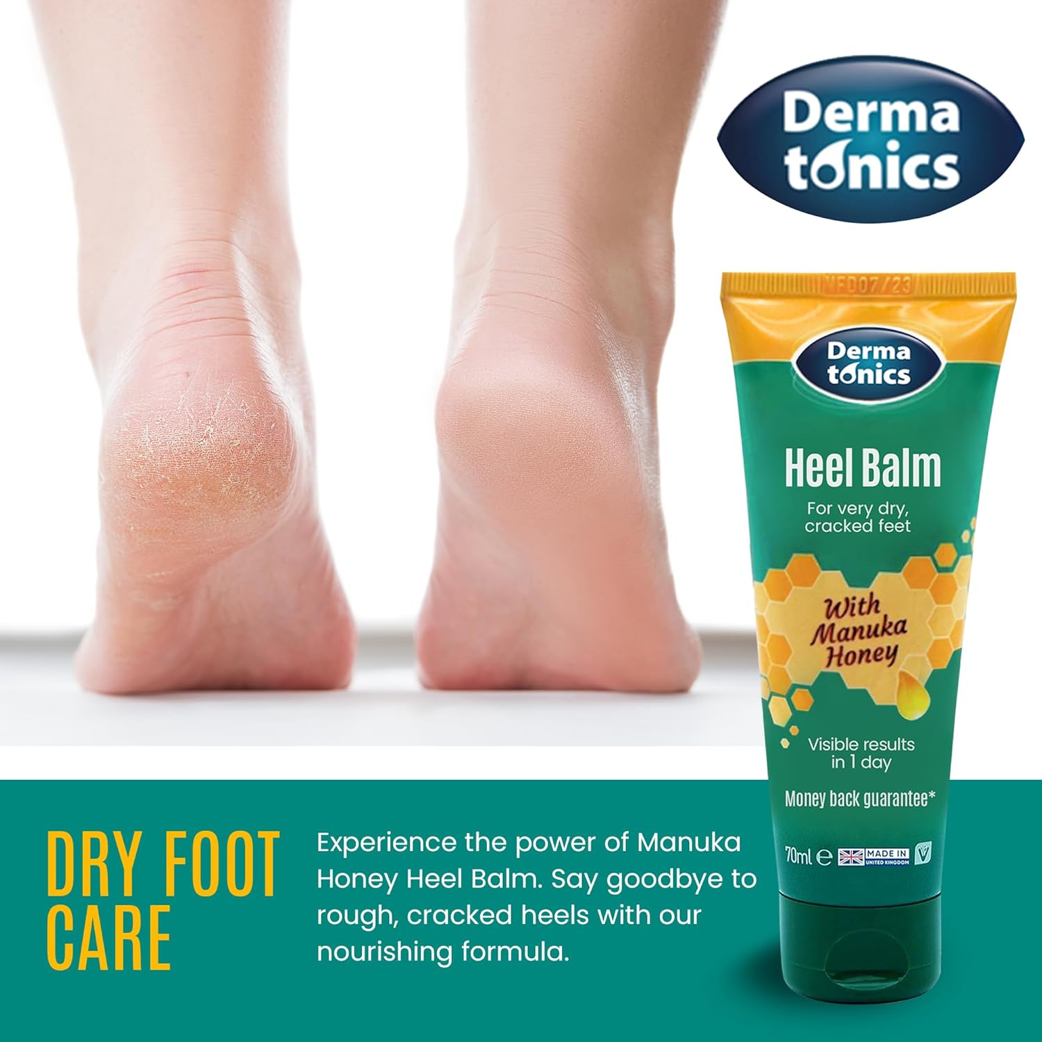 Dermatonics Fast-Acting Manuka Honey Heel Balm | Nourishing Formula for Rough and Cracked Heels | Hydrates and Softens Dry Feet | Suitable for Diabetics| 70 ml : Amazon.co.uk: Beauty