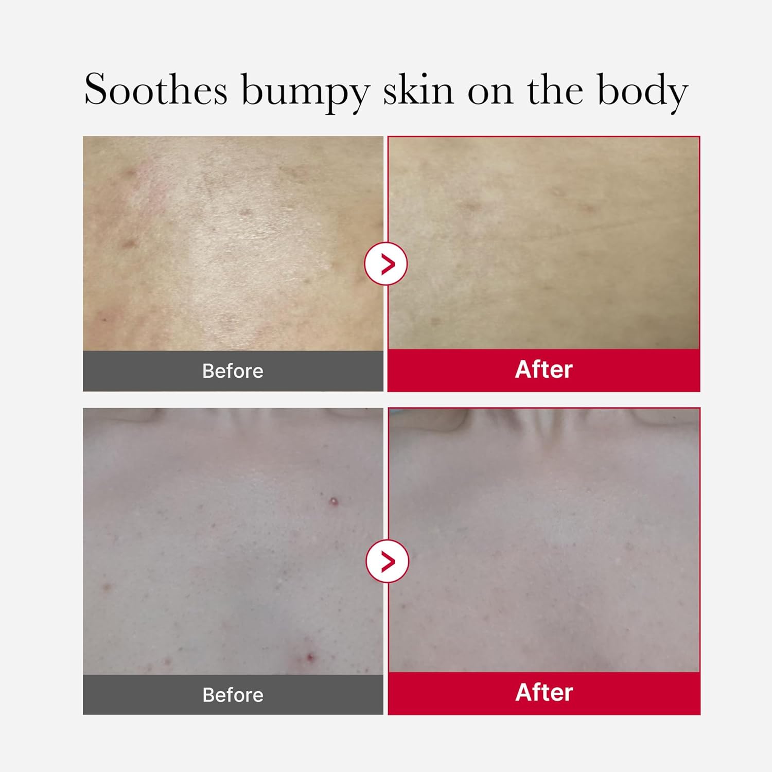 Medicube Red Glow Body Essentials- Red Body Peeling Shot Body Spray Cleanser + Red Body Wash : Beauty & Personal Care