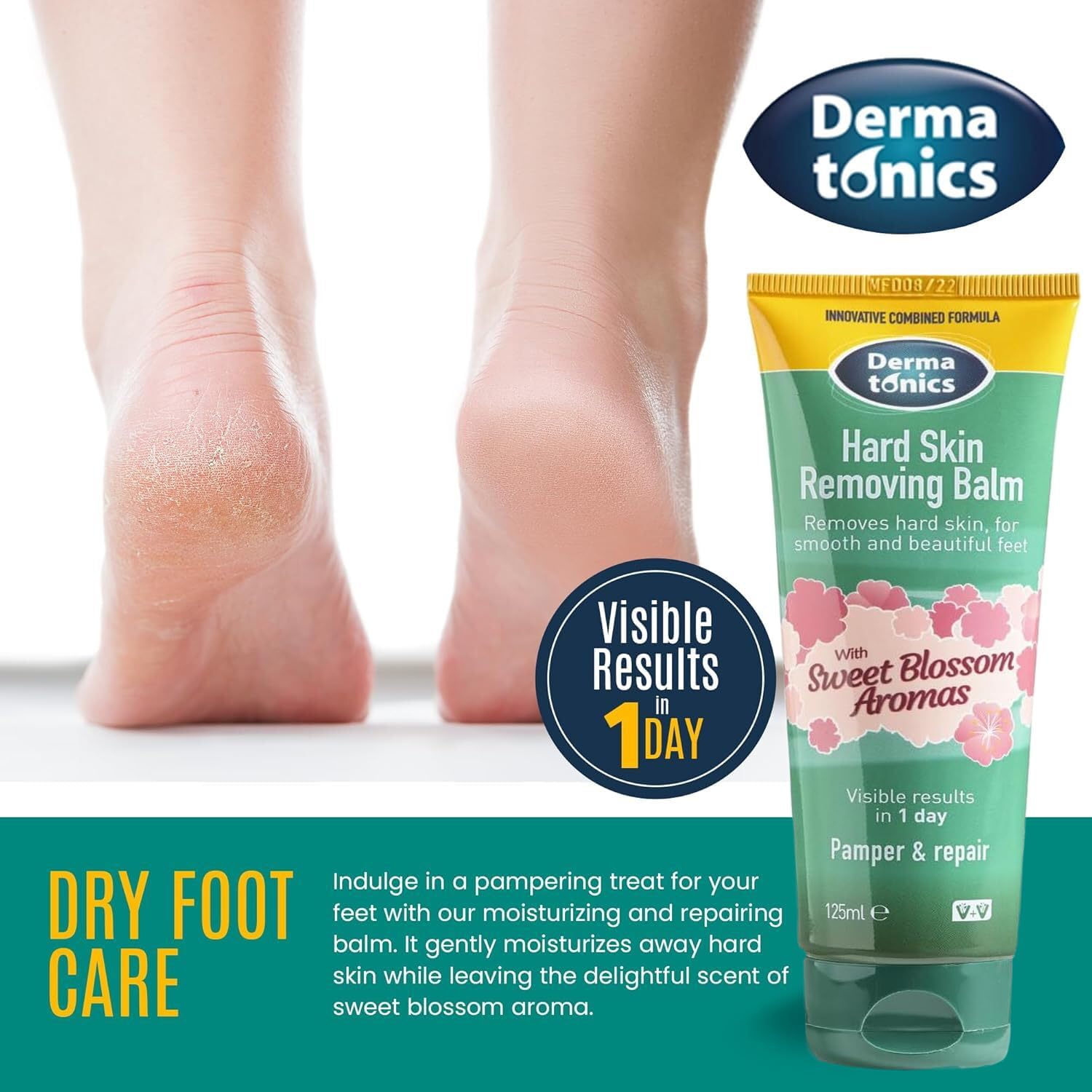 Dermatonics Hard Skin Removing Balm | Suitable For Diabetics | With Sweet Blossom Aromas | Contains Moisturising Shea Butter and Hydrating Swedish Oat Lipid | 125 ml : Amazon.co.uk: Beauty