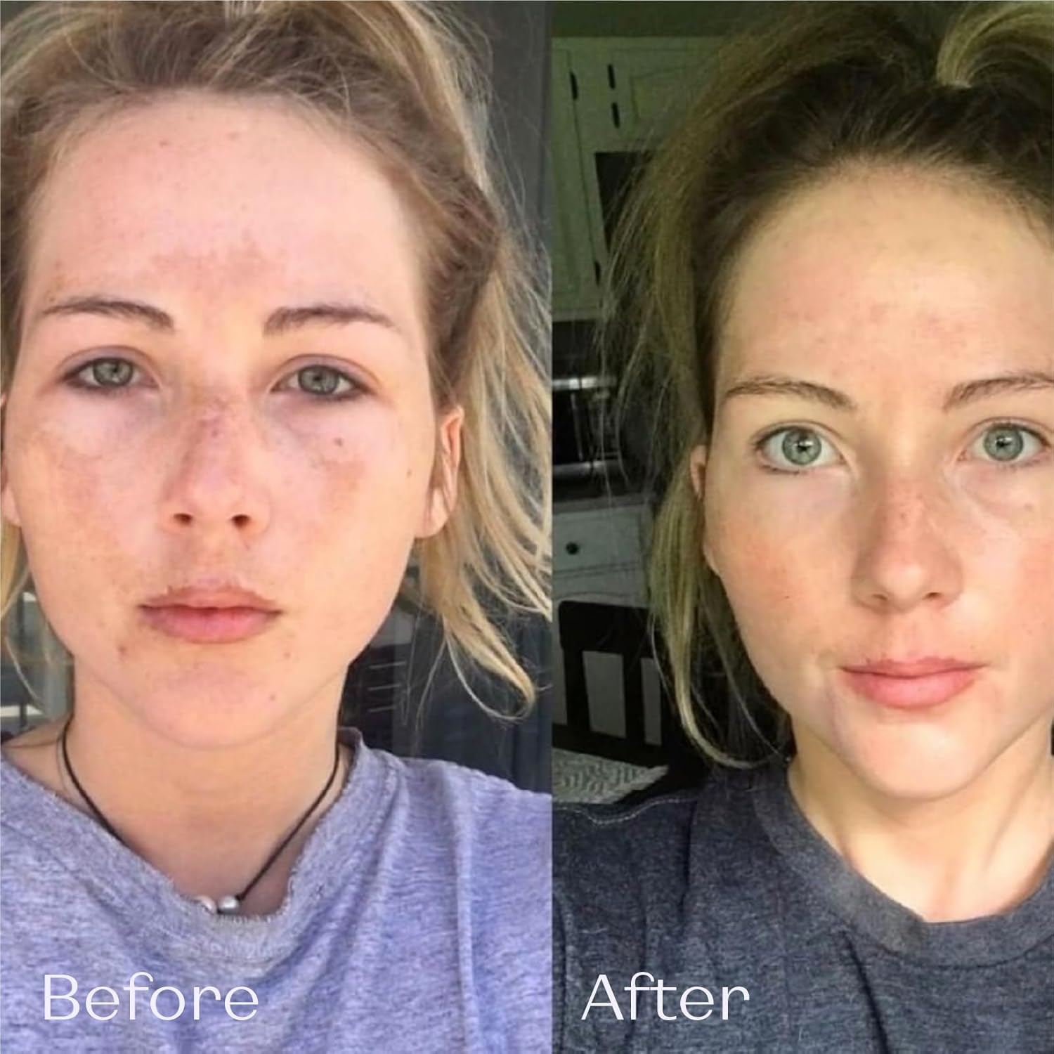 Yonka Phyto 58 Ps Night Cream (50Ml) Anti-Aging Vitamin E Face Moisturizer For Dry Skin, Anti-Wrinkle Night Treatment To Reduce Pores And Revitalize Skin : Beauty & Personal Care