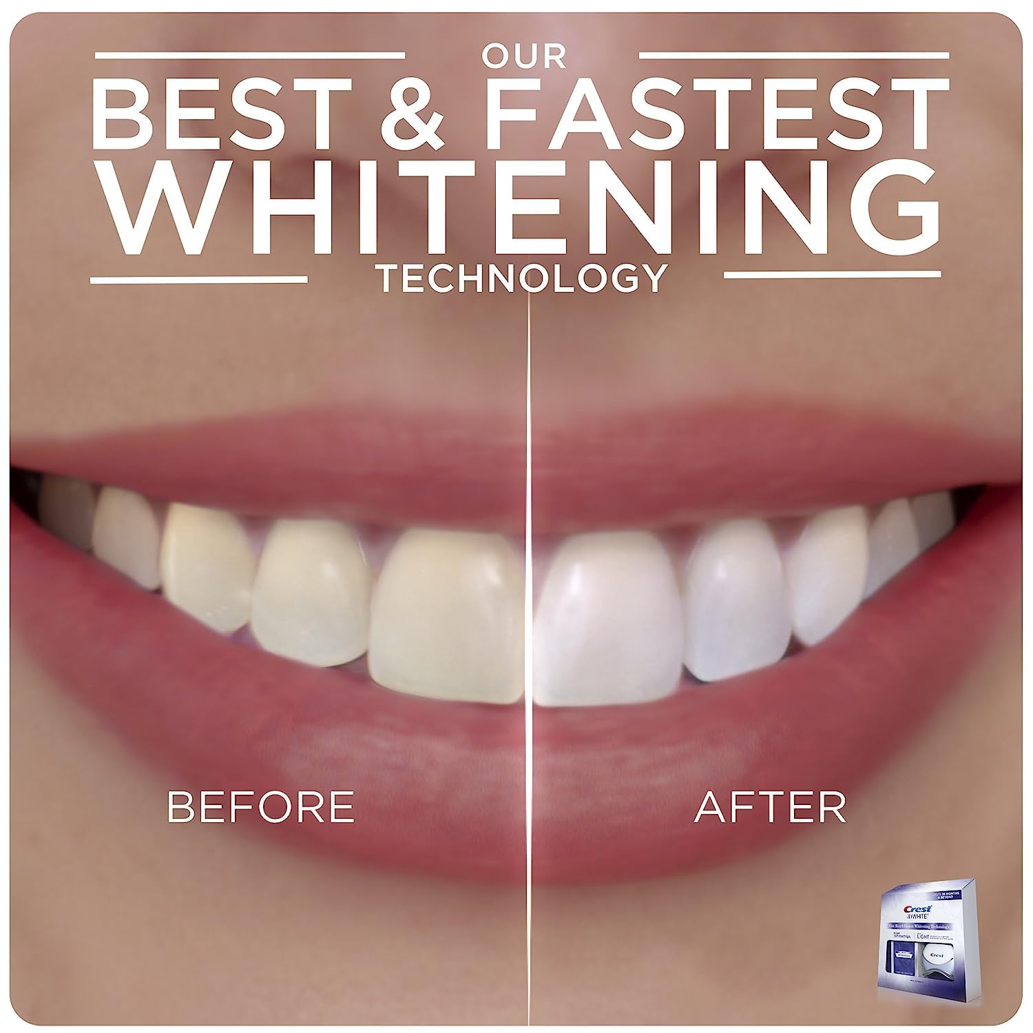 Crest 3D Whitestrips + Led Light – Teeth Whitening Kit, 1 Light + 10 Treatments, Each With 1 Upper/1Lower, 20 Strips – Crest 3Dwhite Teeth Whitening Strips : Health & Household