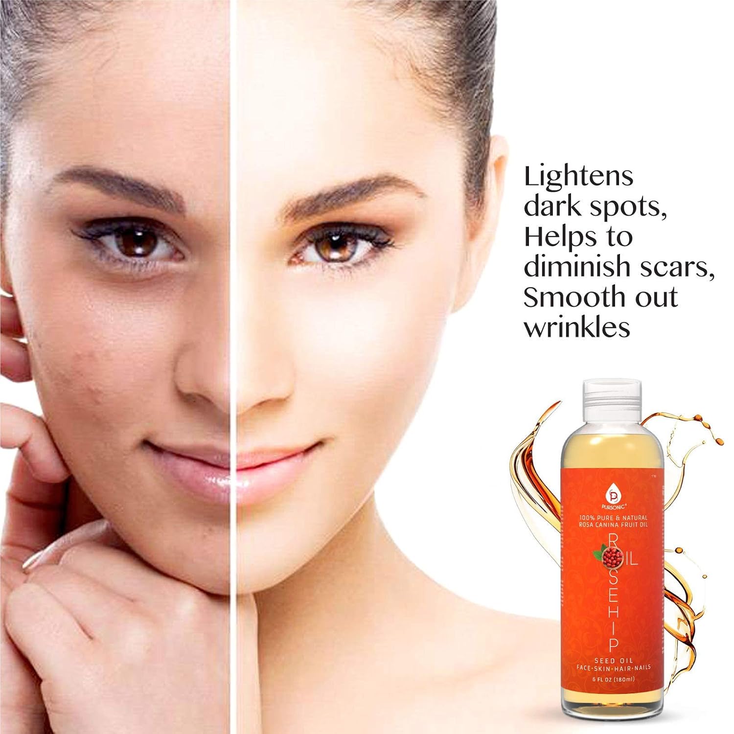 Pursonic Rosehip Oil For Face, Nails, Hair And Skin, 6 Ounce : Beauty & Personal Care