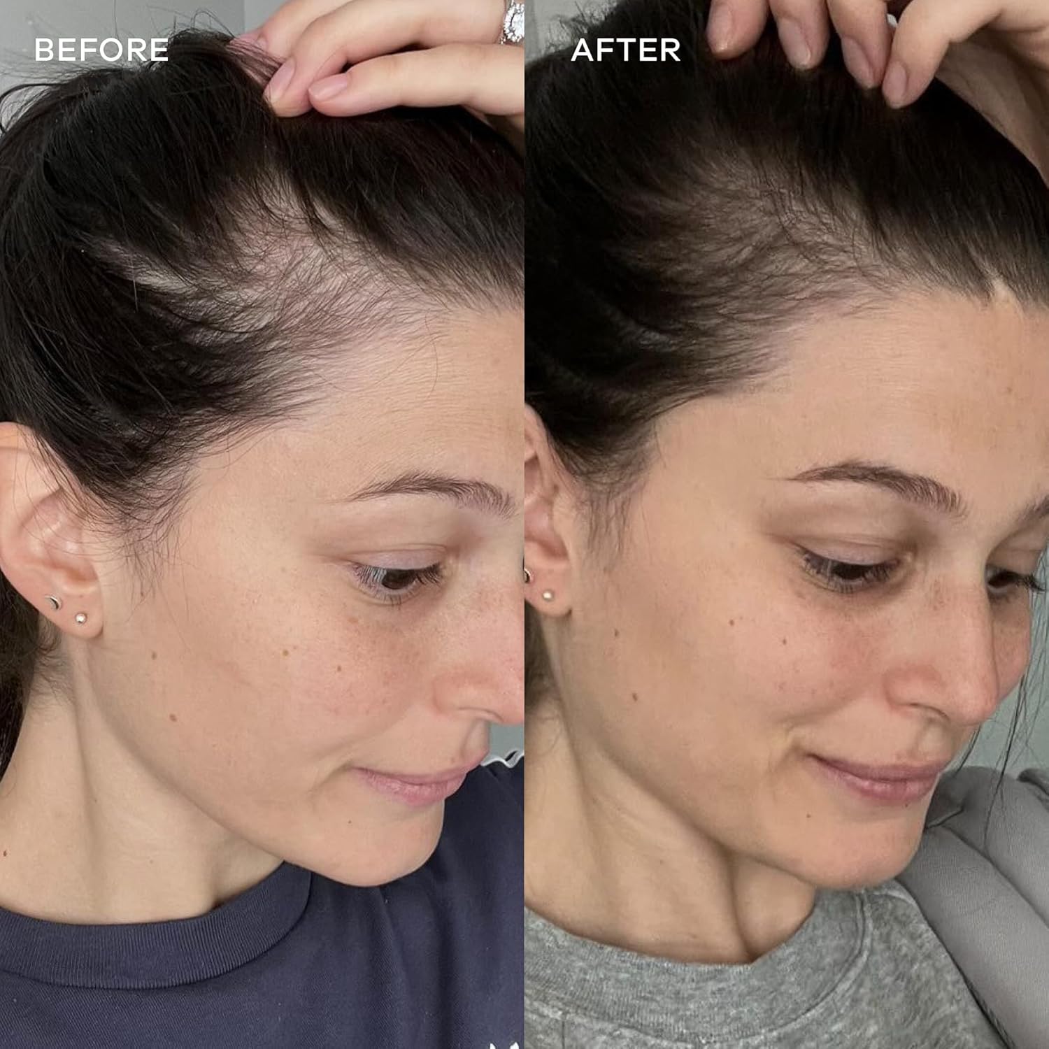 Vida Glow Marine Collagen Powder - Anti Aging Supplement With Collagen Peptides, Promotes Glowing Skin, Strong Nails, Healthy Hair | 30 Servings, Original Flavor (One Size, Blueberry) : Health & Household