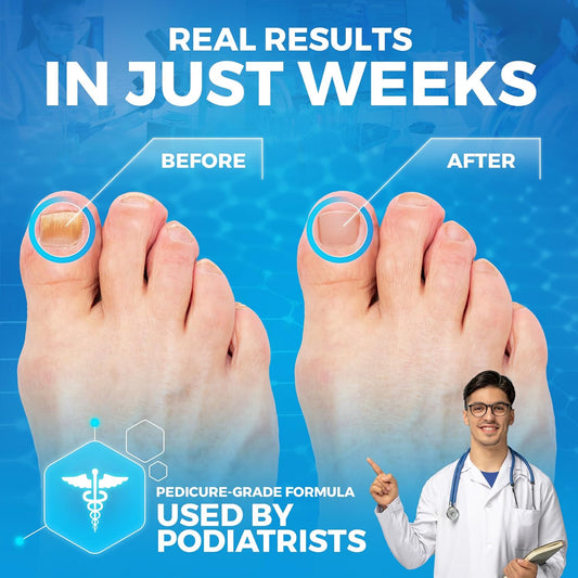 Pedicure Quality Foot Soak With Tea Tree Oil & Epsom Salt | Helps Treat Nail Fungus Athletes Foot | Anti Fungal Nail Treatment | Foot Moisturiser & Deodorizer Feet Soak | Exfoliating Foot Soak