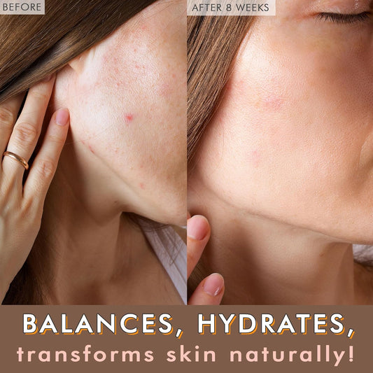 Usda Organic Face Oil – Usa Made With Natural Ingredients, Brightens & Smooths Fine Lines & Wrinkles, Non-Comedogenic Lightweight Facial Oil For Dry & Sensitive Skin With Moringa, Jojoba & Argan Oils