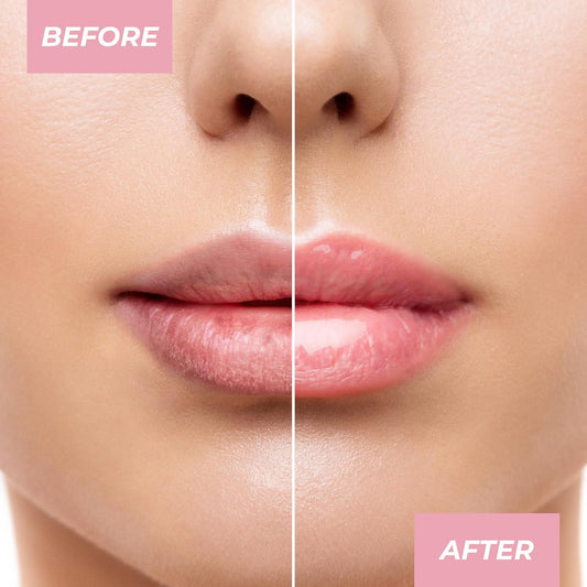 Mcobeauty Overnight Lip Mask - Vanilla, Hydrating Lip Balm, Vegan, Cruelty Free Cosmetics