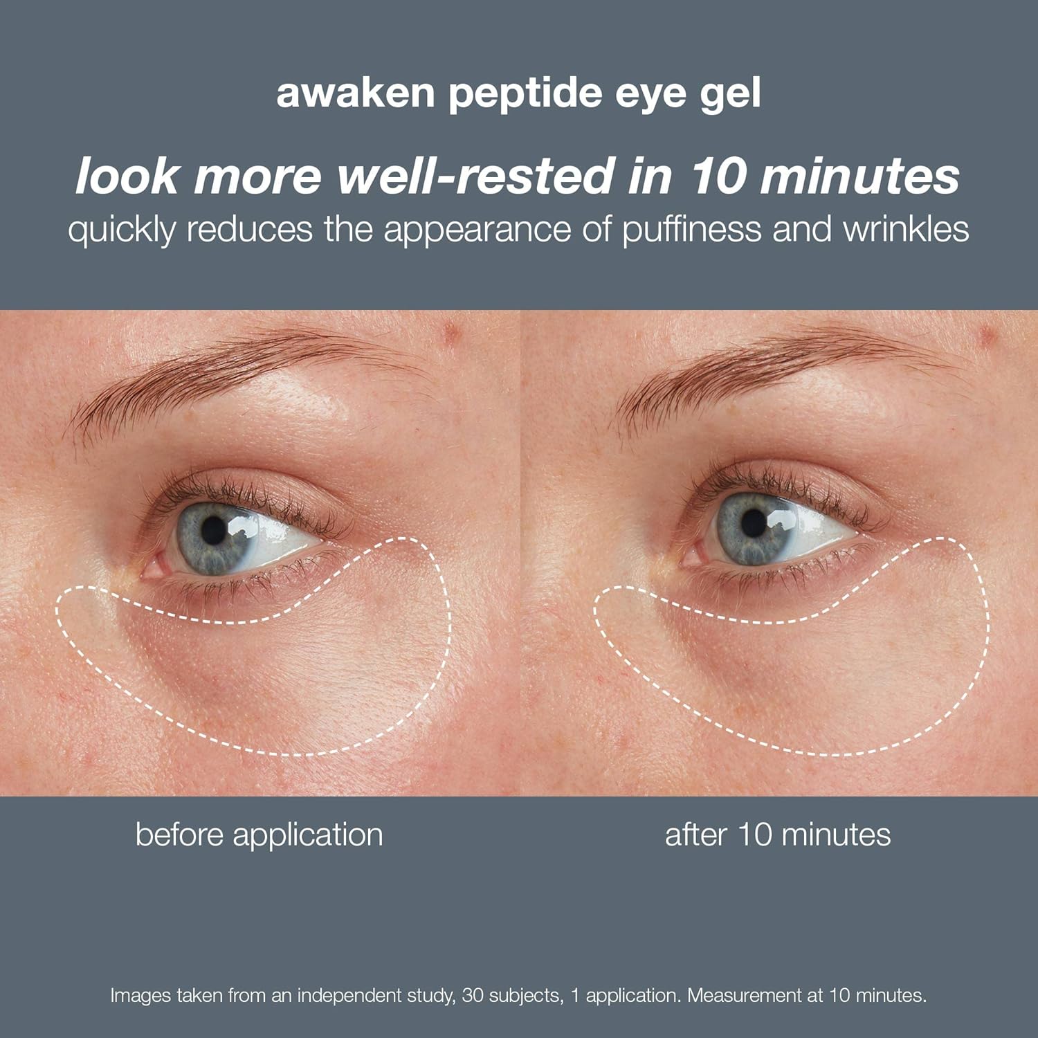 Dermalogica Awaken Peptide Eye Gel - Quickly Reduces The Appearance Of Puffiness And Wrinkles : Beauty & Personal Care