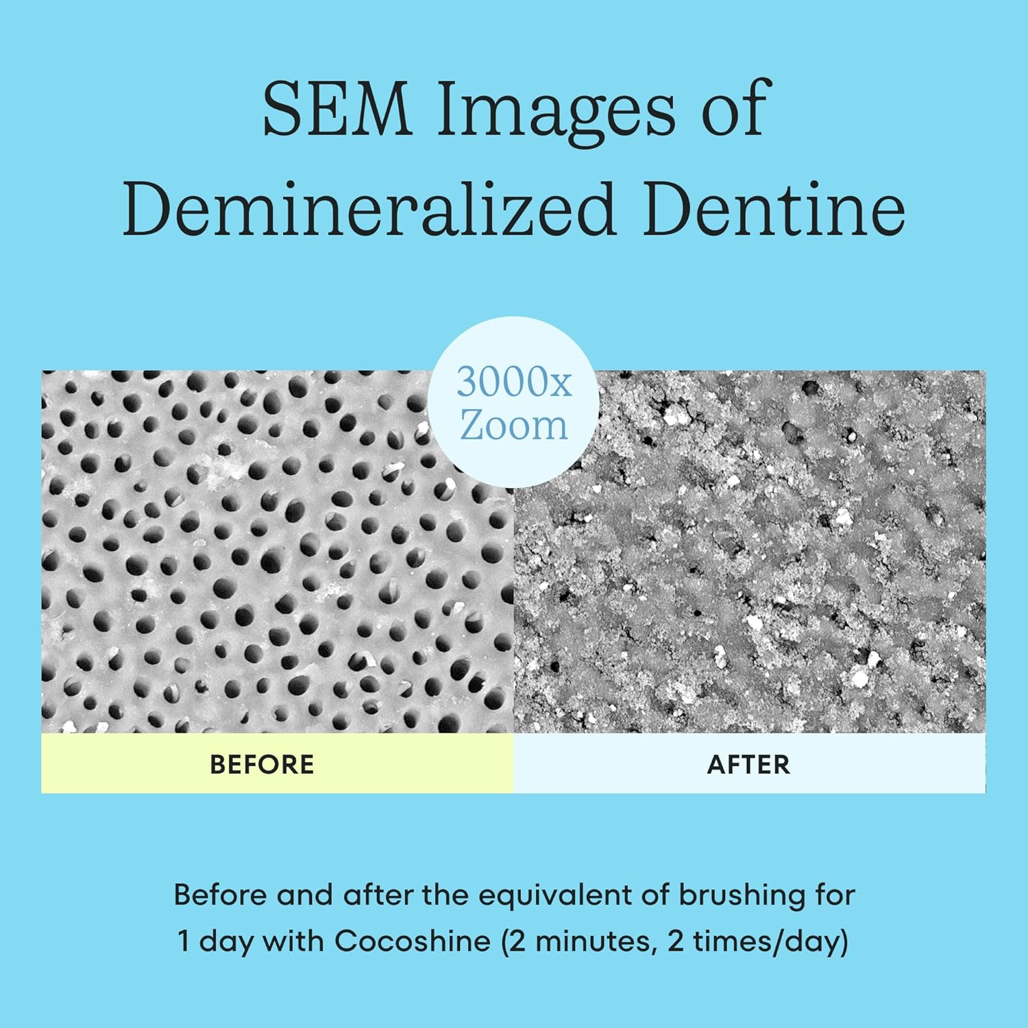 Cocolab Cocoshine Whitening Toothpaste, Remineralize & Repair Sensitive Teeth, Fluoride-Free With N-Ha, Kid-Friendly, Pina Colada, 3.4 Oz : Health & Household