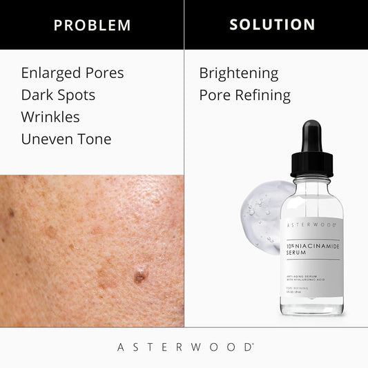 Asterwood 10% Niacinamide Serum For Face - Anti-Aging, Pore Minimizing, Hydrating - With Vitamin B3 And Hyaluronic Acid - Tone, Texture - Fragrance-Free - 1 Fl Oz