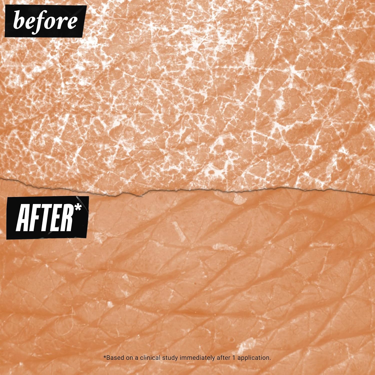 Kiehl'S Ultra Body Barrier Repair Cream, Hydrating Body Lotion, Formulated For Sensitive Skin And Safe For Eczema - 8.4 Fl Oz : Beauty & Personal Care